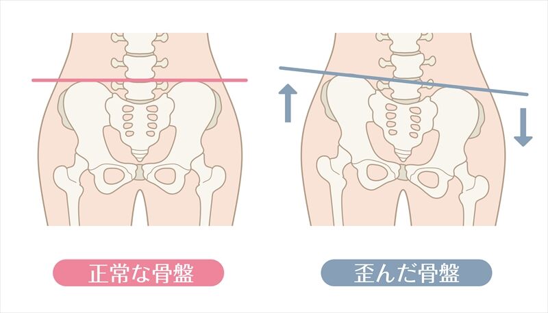 骨盤